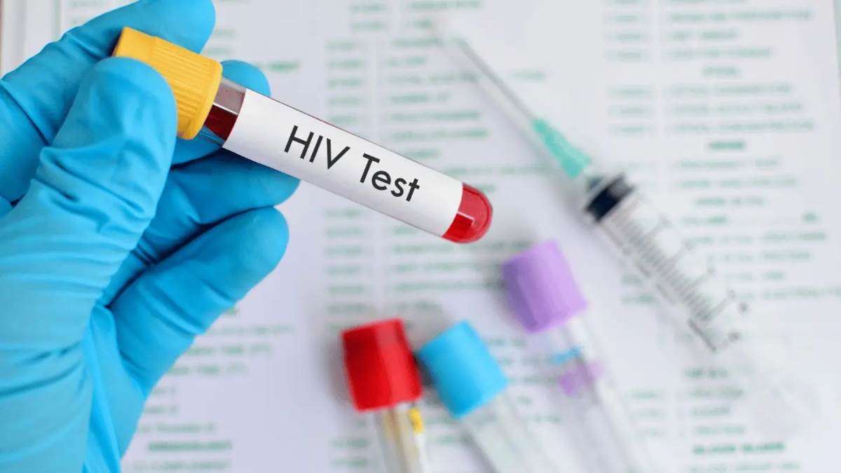 शादी से पहले HIV Test कराना होगा Compulsory, इस राज्य में कानून लाने जा रही सरकार - Meghalaya Considers Mandatory HIV Tests Before Marriage Amid Rising AIDS Cases