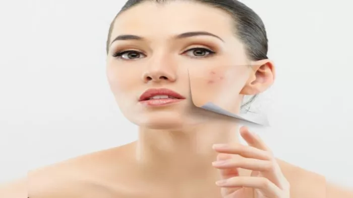 Health Tips: त्वचा रोग का घर में न करें इलाज। विशेषज्ञों से लें सलाह।