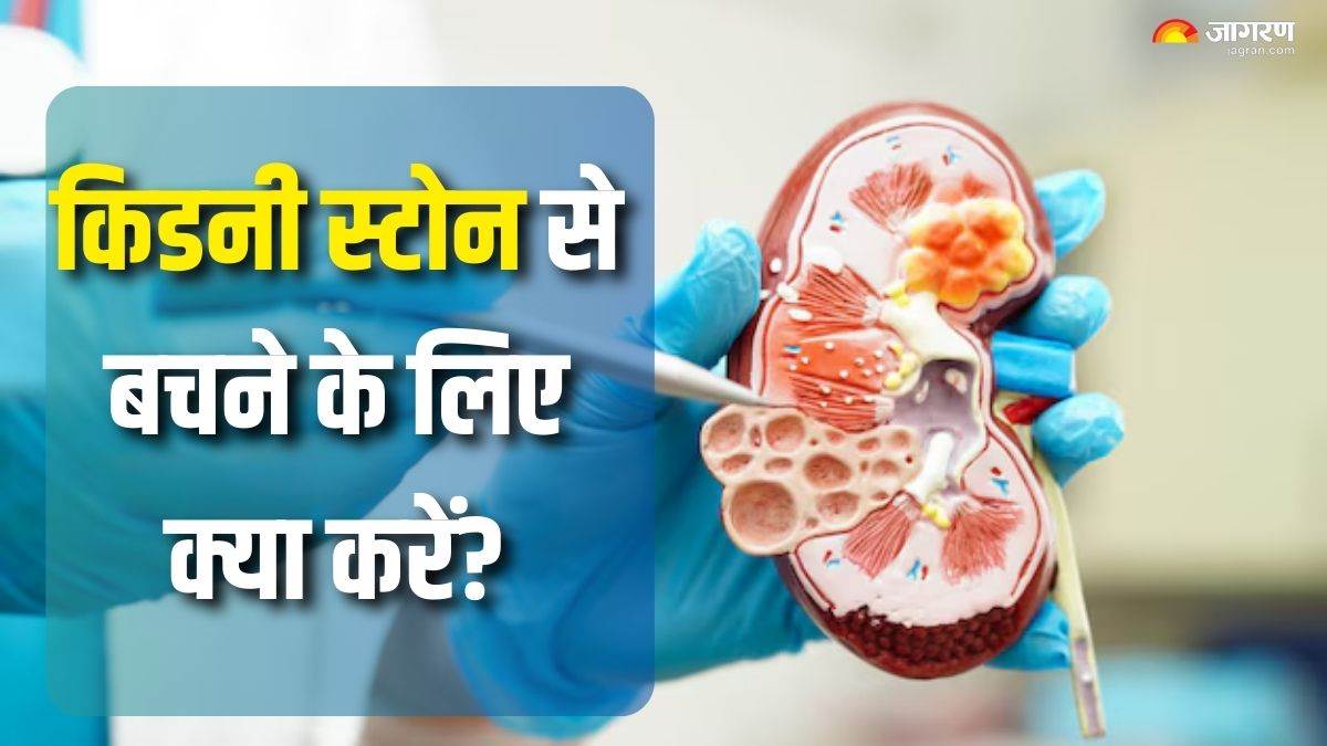 https://www.jagranimages.com/images/newimg/25082025/25_08_2025-kidney_stone_prevention_tips_24024327.jpg