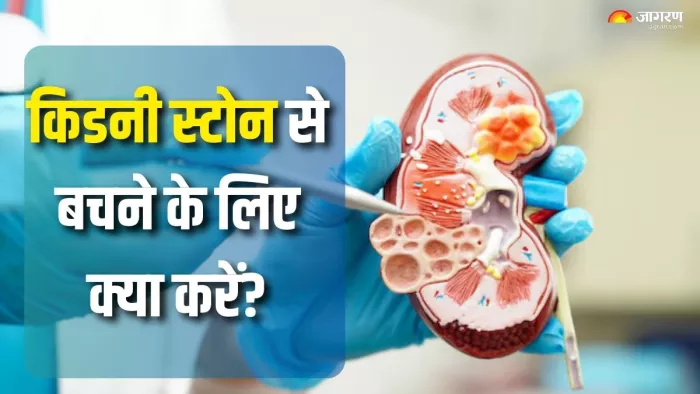 किडनी में पथरी बनने का खतरा कैसे कम करें? (Picture Courtesy: Freepik)
