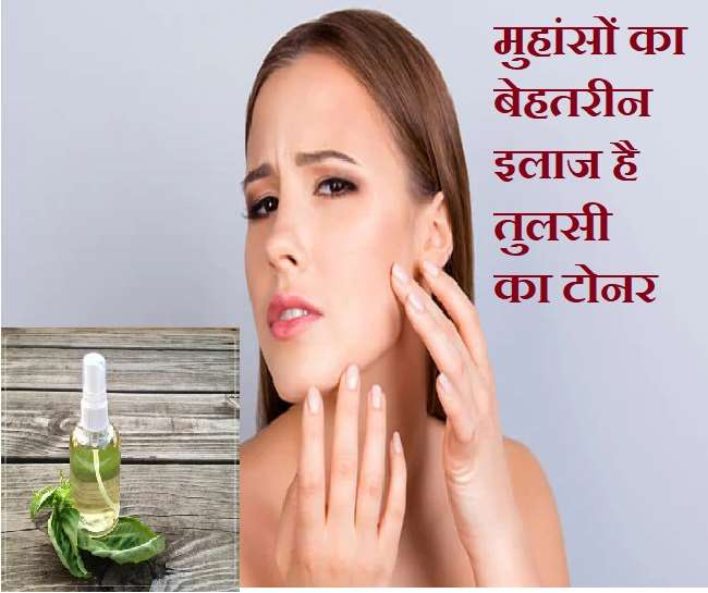 how to use basil for acne know the easy ways to get a clear skin with the herb