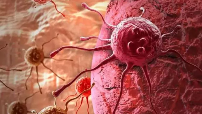 Blood Cancer: मोटापे से ग्रस्त डायबिटिक महिलाओं को सर्जरी से होता है ज्यादा फायदा