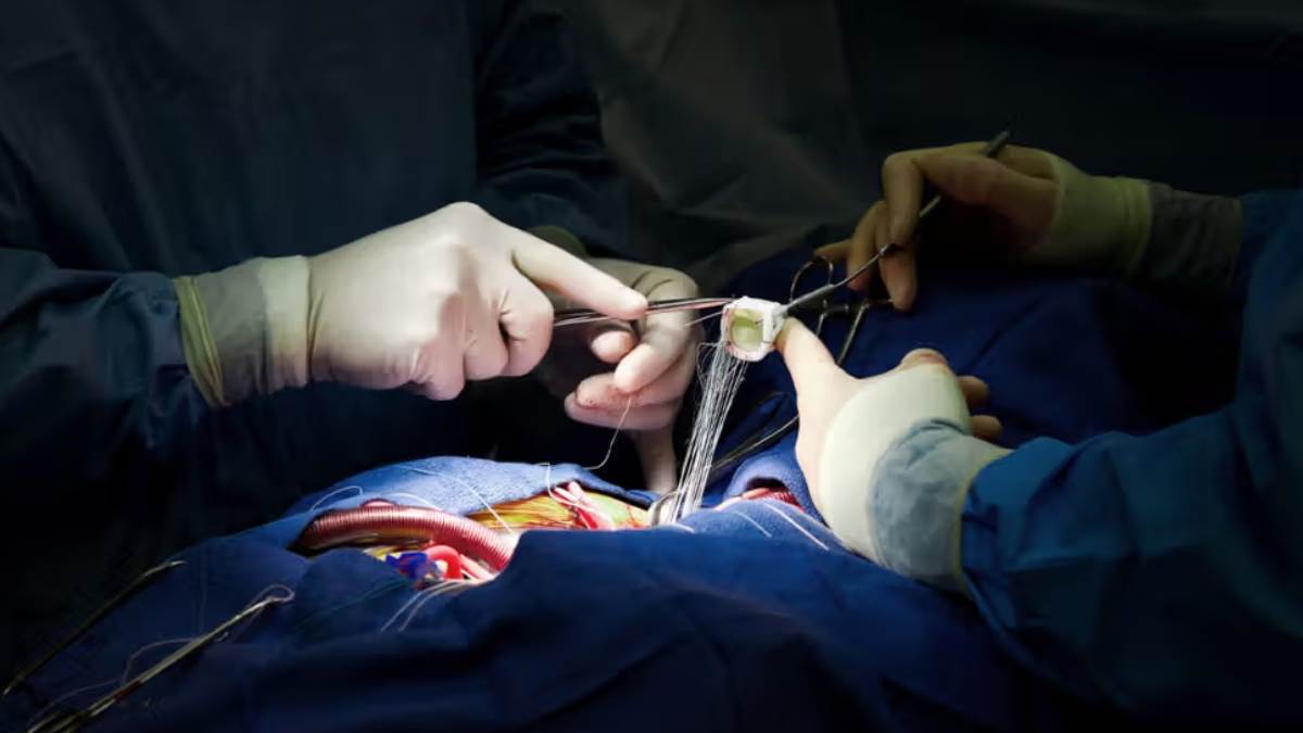 https://www.jagranimages.com/images/newimg/25092025/25_09_2025-surgery_24059077.jpg