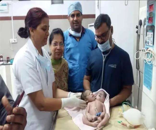 21 वर्षीय महिला ने 2 सिर 3 हाथ वाले बच्चे को दिया जन्म, डॉक्टर्स भी हैरान