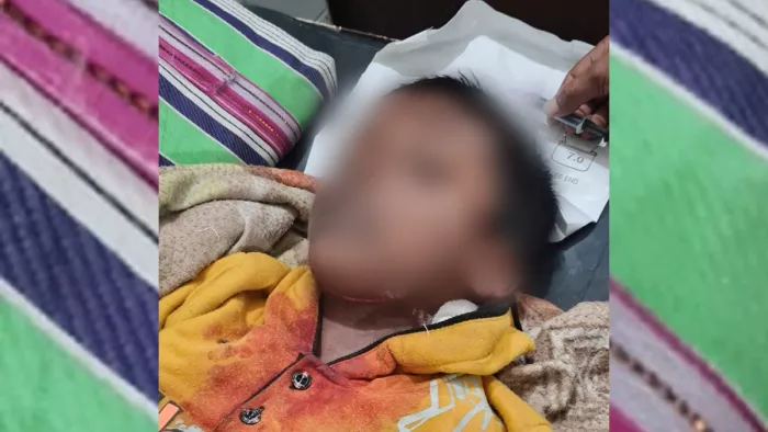 दरभंगा में पहली कक्षा के छात्र ने दोस्त को गले पर मारी ब्लेड