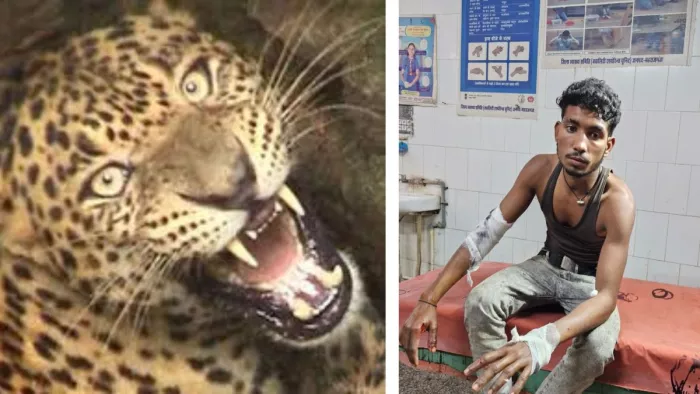तेंदुए के हमले से घायल युवक। जागरण