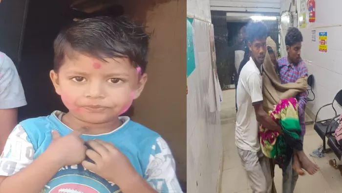 कई सदस्य बुरी तरह झुलस गए। इनमें से सिकंदर लाल के चार वर्षीय पुत्र शुभम की मौत हो गई।