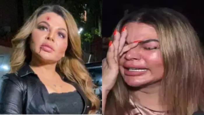 Rakhi Sawant Video: राखी सावंत फिल्म एक्ट्रेस है।