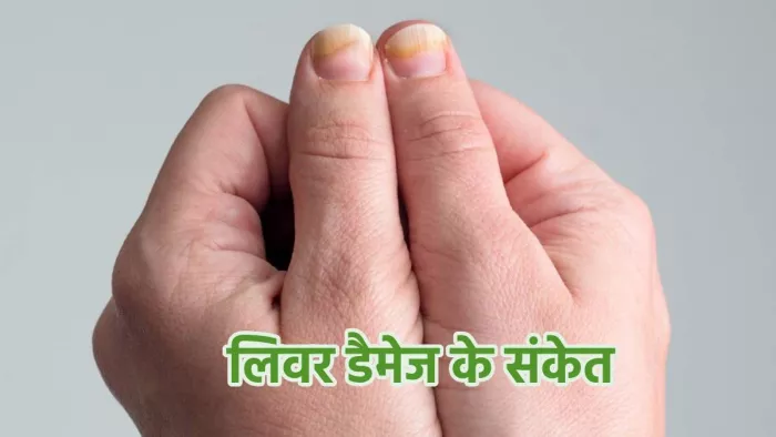 नाखूनों में नजर आने वाले ये बदलाव करते हैं लिवर डैमेज की ओर इशारा