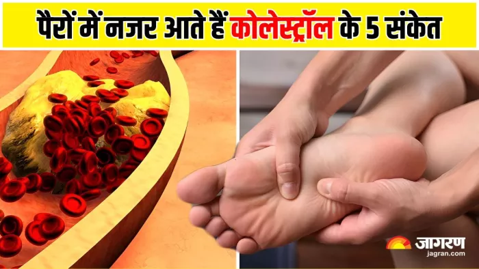 Cholesterol Warning Signs: पैरों में दिखने लगें 5 लक्षण, तो समझ जाएं चुपके से बढ़ रहा है कोलेस्ट्रॉल (Image: Freepik)