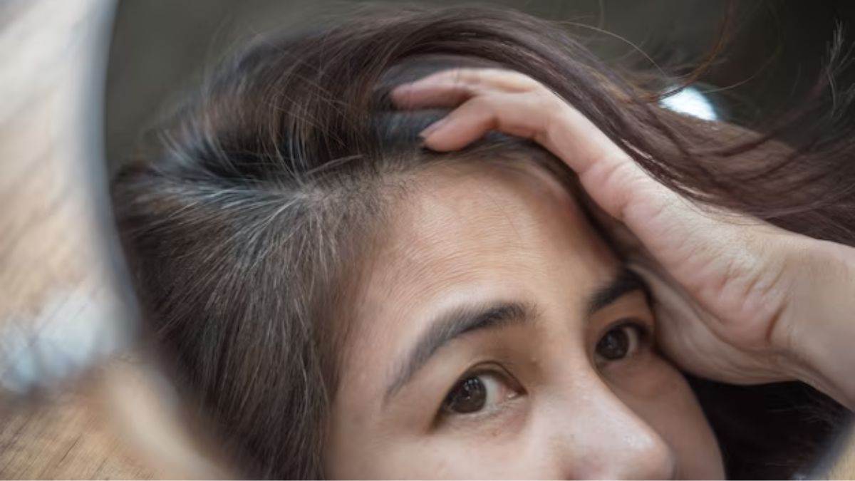 https://www.jagranimages.com/images/newimg/26022025/26_02_2025-grey_hair_23890953.jpg