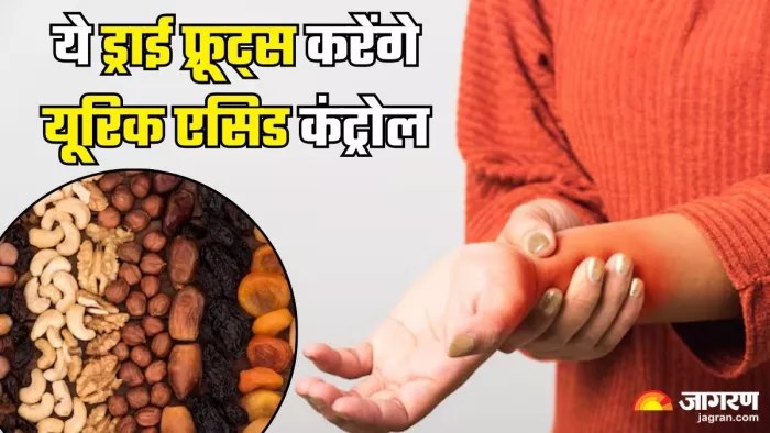 हाई यूरिक एसिड कंट्रोल करेंगे ये ड्राई फूड्स (Picture Credit- Freepik)