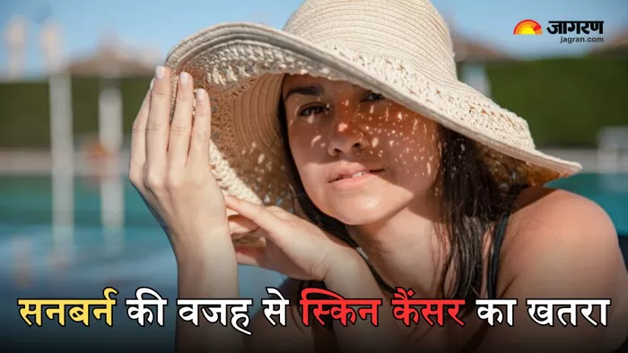 क्या सनबर्न की वजह से स्किन कैंसर हो सकता है?