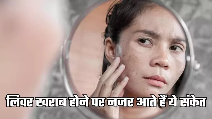 लिवर खराब होने पर स्किन पर नजर आते हैं ये संकेत (Picture Credit- Freepik)