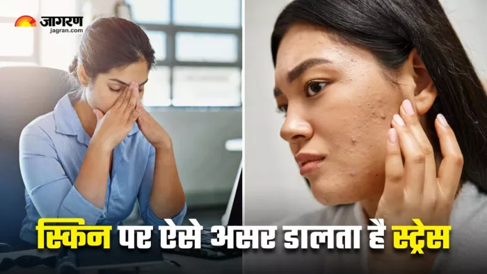 त्वचा पर नजर आएं ये 5 लक्षण, तो समझ जाएं कि आप बहुत ज्यादा तनाव में हैं! (Image Source: Freepik)