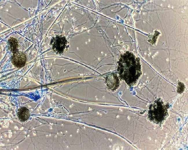 https://www.jagranimages.com/images/newimg/26052021/26_05_2021-black_fungus_testing_21677869.jpg