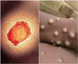 Monkeypox in India : भारत में इस बीमारी से जुड़ा कोई मरीज नहीं है।