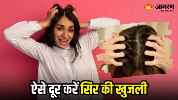 गर्मियों में सिर की खुजली से हैं परेशान, तो आज ही अपनाएं ये 5 असरदार उपाय (Image Source: Freepik)