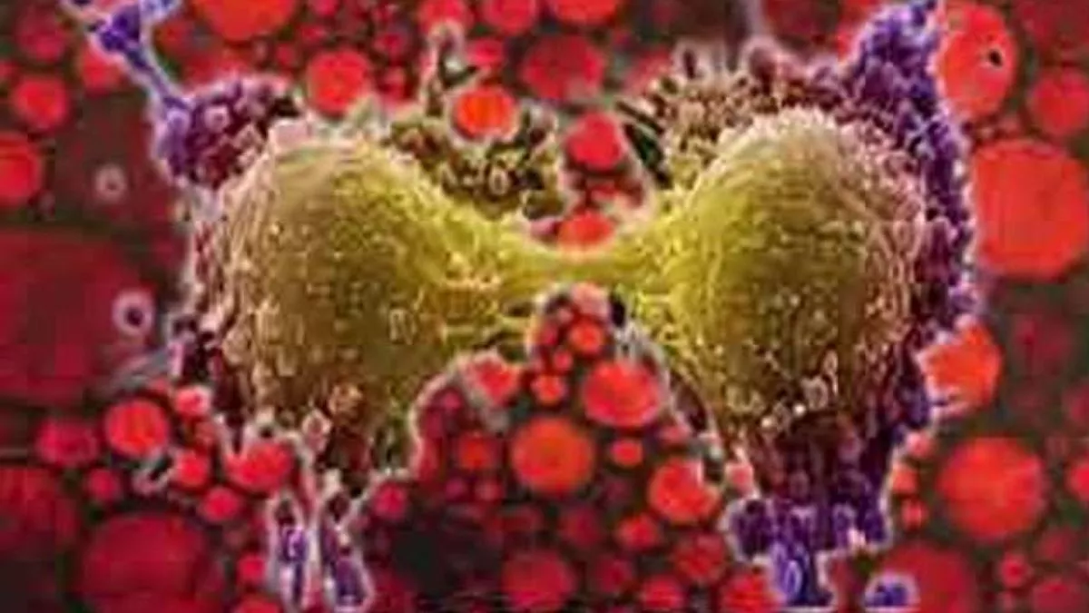 Oral Cancer in Bihar: बिहार में ओरल कैंसर की सुनामी, हर साल डेढ़ लाख लोग होते हैं शिकार; 50% की हो जाती है मौत