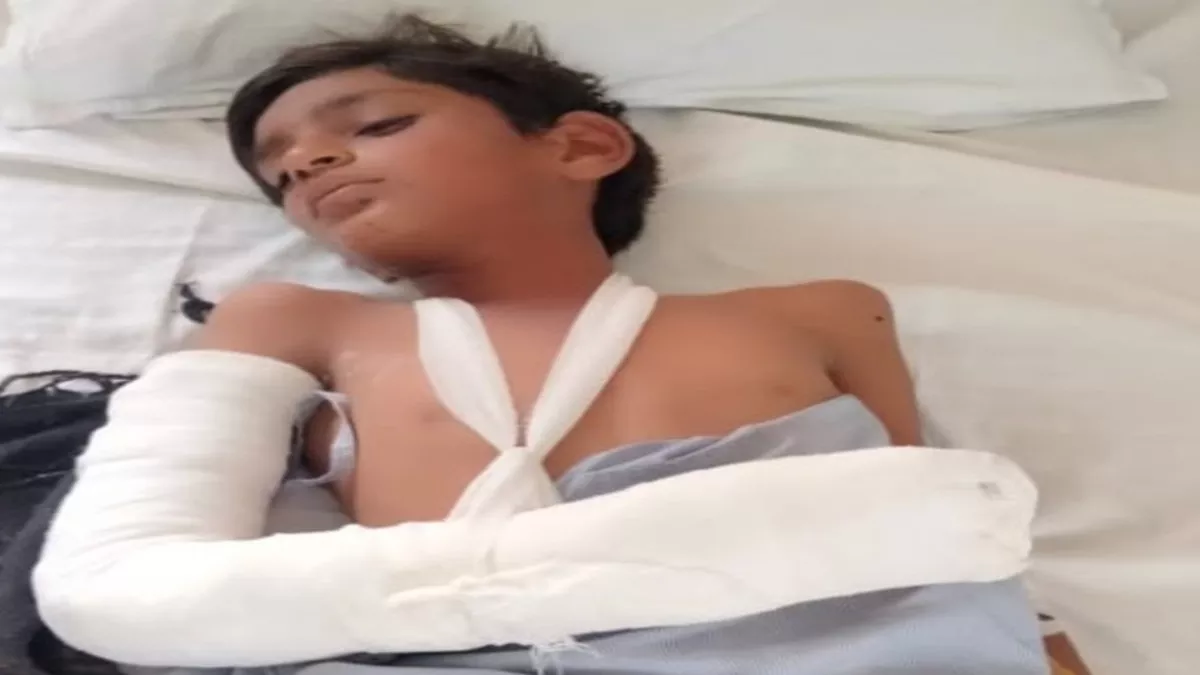Rajasthan: मोबाइल बैटरी में हुआ ब्लास्ट, आपरेशन कर बच्चे की हथेली को काटकर अलग करना पड़ा
