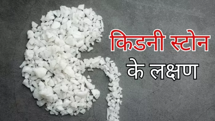 इन चार लक्षणों से करें पथरी की पहचान