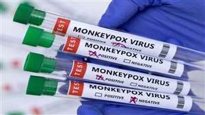 Monkeypox Alert in Agra: मंकीपॉक्स के लिए आगरा में आइसोलेशन वार्ड बना दिया गया है।