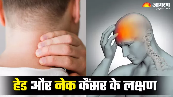 युवाओं में तेज़ी से बढ़ रहा सिर और गर्दन का कैंसर (Picture Credit- Freepik)