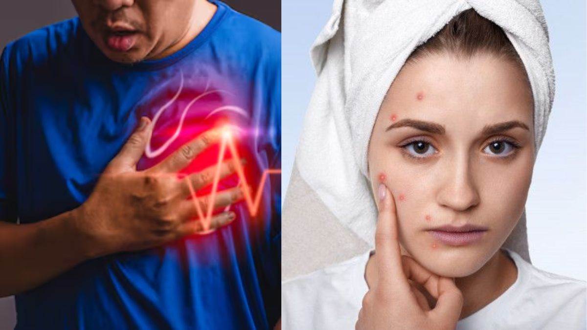 https://www.jagranimages.com/images/newimg/26072025/26_07_2025-heart_disease_1_23994746.jpg