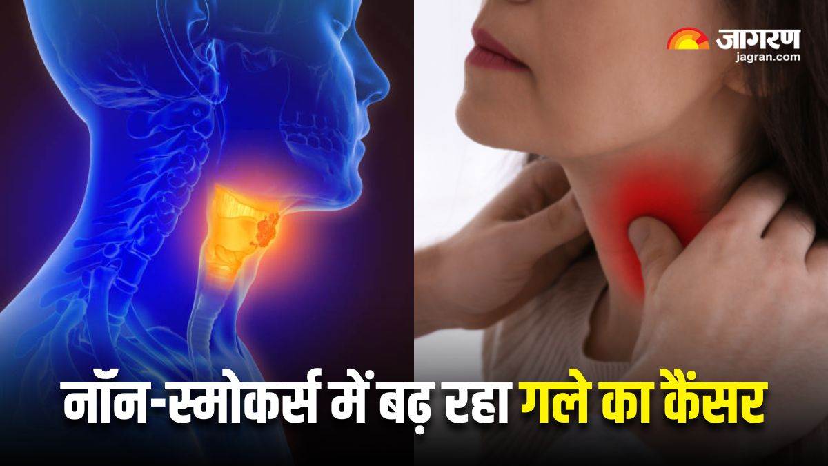 https://www.jagranimages.com/images/newimg/26072025/26_07_2025-throat_cancer_non_smokers_23995028.jpg