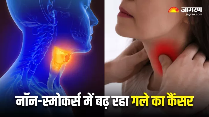 नॉन-स्मोकर्स में भी बढ़ रहा गले का कैंसर! (Image Source: Freepik)
