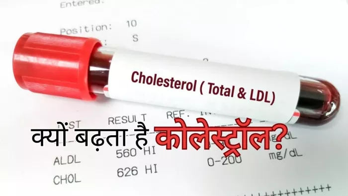 एक धीमे ज़हर की तरह काम करता है हाई कोलेस्ट्रॉल
