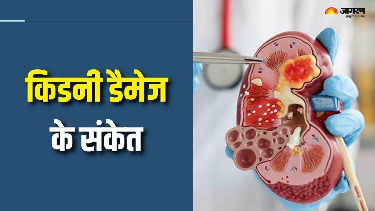 https://www.jagranimages.com/images/newimg/26082025/26_08_2025-kidney_damage_signs_in_morning_24025377.jpg