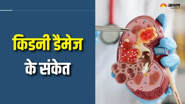 किडनी डैमेज होने का पता कैसे लगाएं? (Picture Courtesy: Freepik)