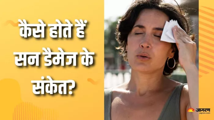 इन लक्षणों से लगाएं सन डैमेज का पता (Picture Courtesy: Freepik)