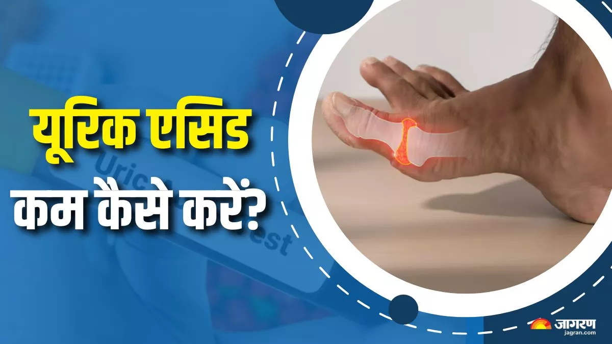 अगर शरीर में बढ़ गया है यूरिक एसिड, तो तेजी से कम करने के लिए करना शुरू कर दें ये 5 काम