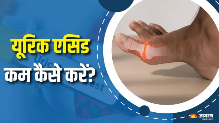 कैसे कम होगा यूरिक एसिड? (Picture Courtesy: Freepik)