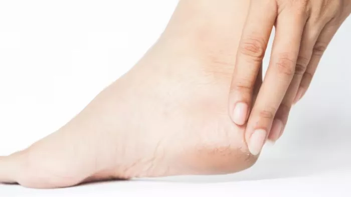 Tips For Cracked Heels: इस तरह पाएं फटी एड़ियों से राहत