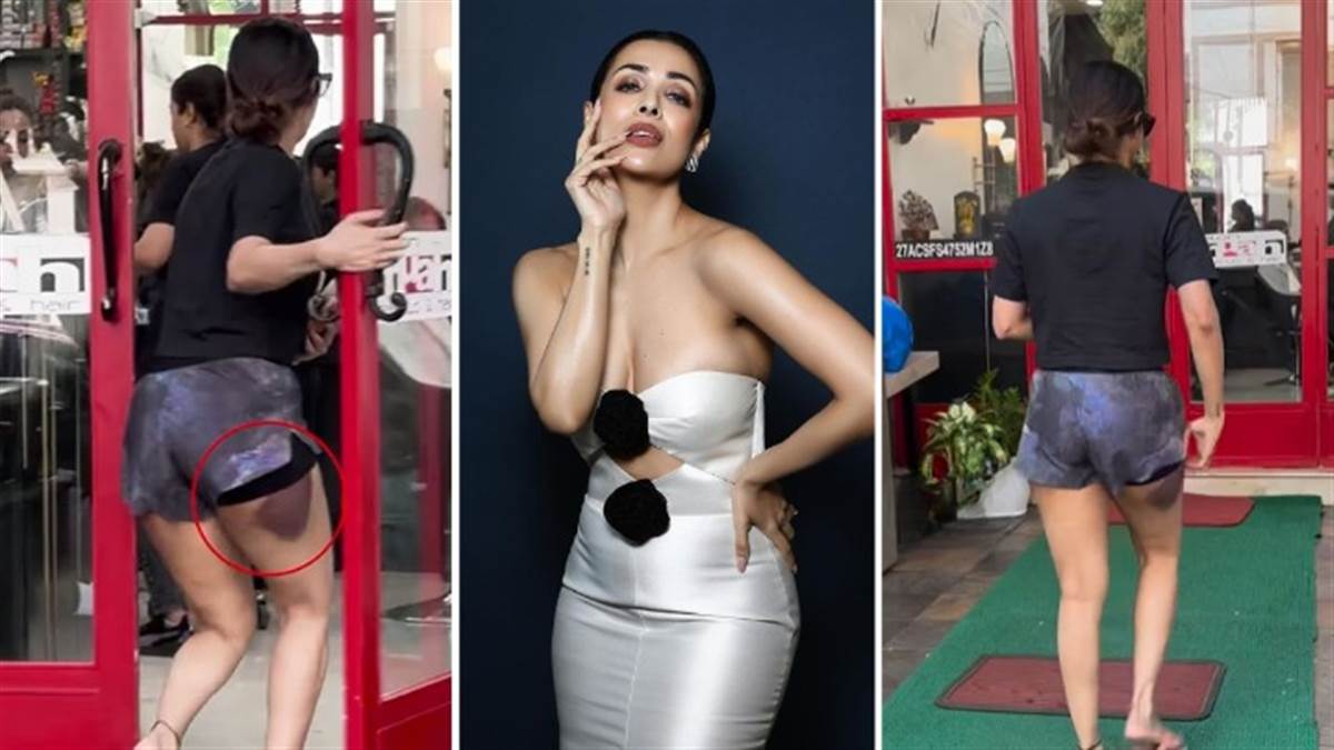 https://www.jagranimages.com/images/newimg/26102023/26_10_2023-malaika_arora_injury_cleanup_1_23565732.jpg
