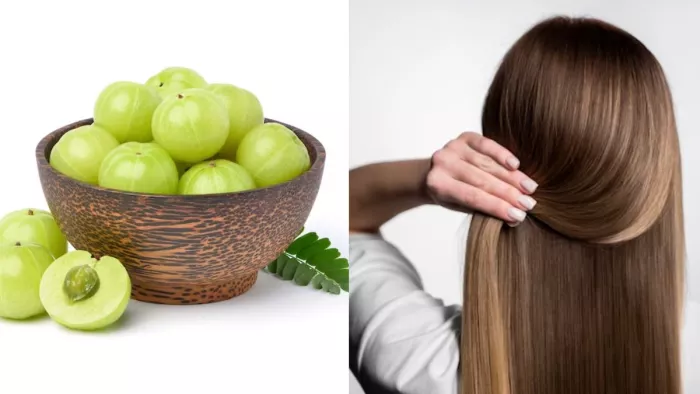 Amla For Hair: बालों की समस्या का इलाज है आंवला