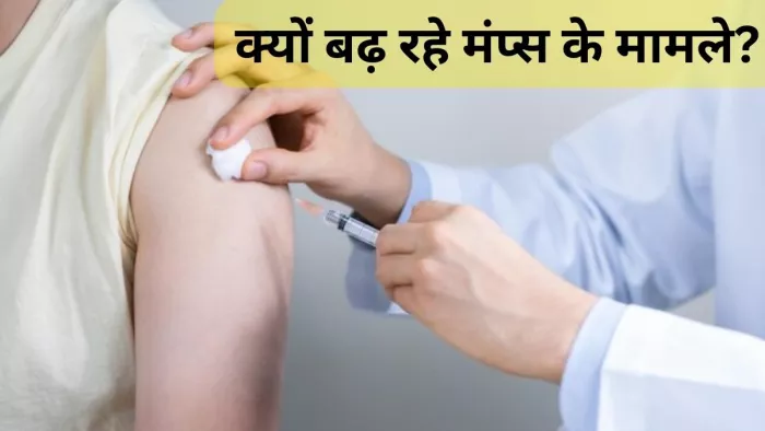 एक्सपर्ट से जानें क्यों बढ़ रहे मंप्स के मामले