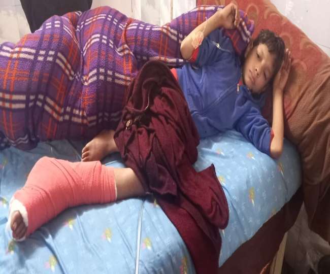 https://www.jagranimages.com/images/newimg/27012022/27_01_2022-leg_cut_22415876.jpg