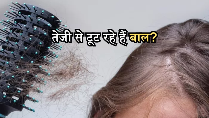 क्या है एलोपीसिया एरेटा, जिसमें तेजी से झड़ते हैं बाल?
