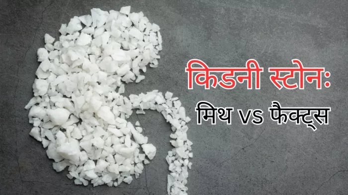 क्या आप भी करते किडनी स्टोन से जुड़े इन मिथकों पर यकीन