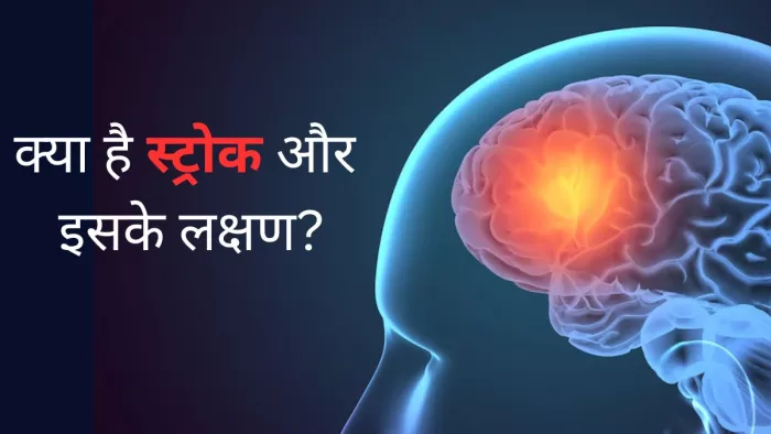 जानें क्या है स्ट्रोक और इसके लक्षण