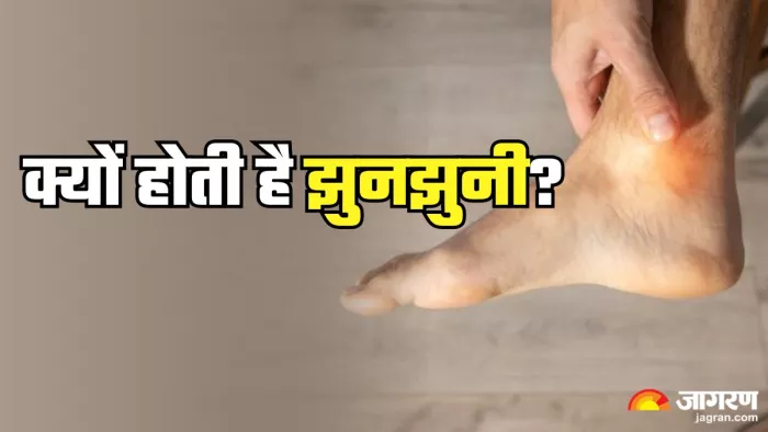जानें क्यों होती है झुनझुनी (Picture Credit- Freepik)