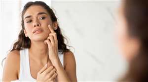 Aloe Vera For Acne: एलोवेरा से पिंपल हटाने के उपाय