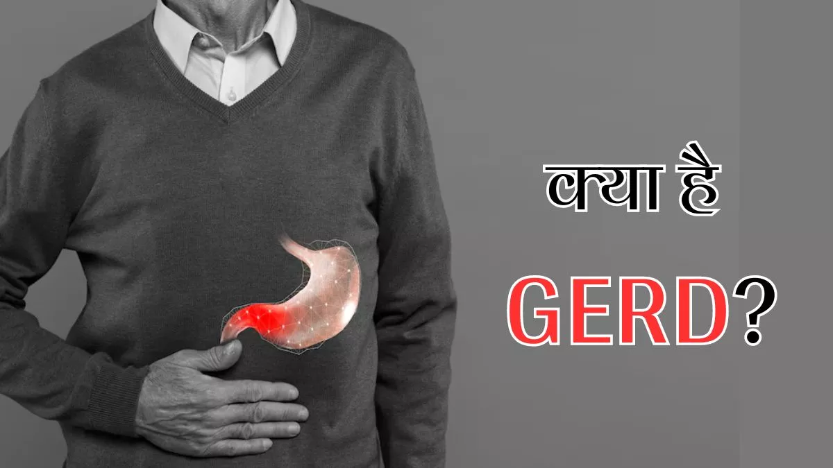 GERD: क्या है गैस्ट्रोइसोफेजियल रिफ्लक्स डिजीज, जानें इससे जरूरी सभी जरूरी बातें