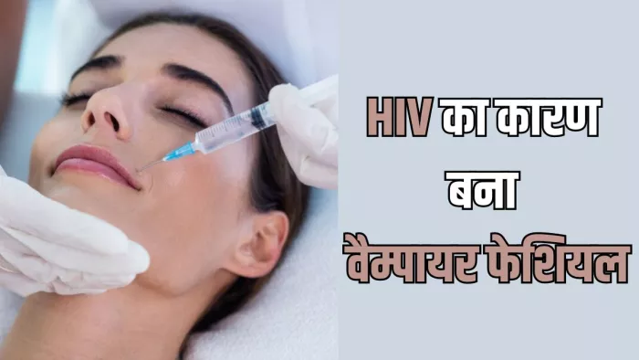 Vampire Facial कराने के बाद HIV का शिकार हुई महिला