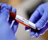 LIVE Coronavirus Kanpur: कन्नौज में चार और कोरोना पॉजिटिव मिलने के बाद संख्या हुई 42, कानपुर में 337