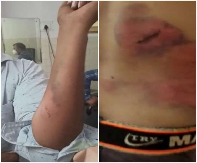 Raebareli Police brutally beaten youth in lockup allegation of abused police